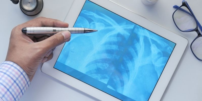 How to Start a Career in Radiography